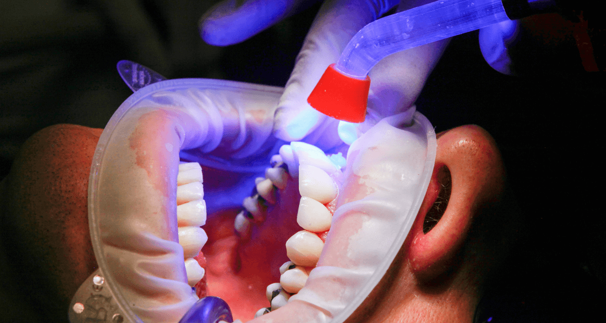 https://monalisasmiledental.com/wp-content/uploads/2023/03/5-dental-issues-that-require-surgery-in-San-Ramon-1200x640.png