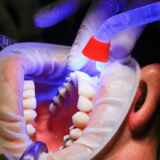 5 dental issues that require surgery in San Ramon