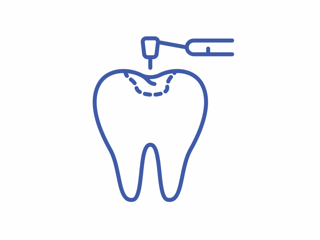 Dental Fillings