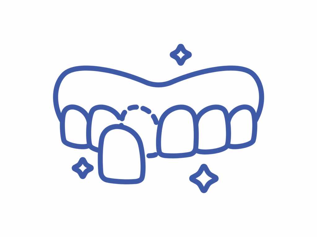 Crowns and Veneers