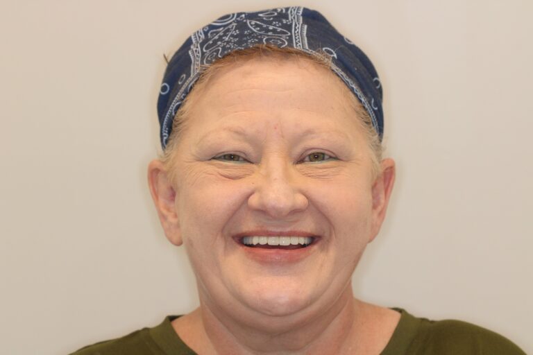 Patient showing a bright smile after cosmetic dentistry treatment at Mona Lisa Smile Dental in Walnut Creek, CA