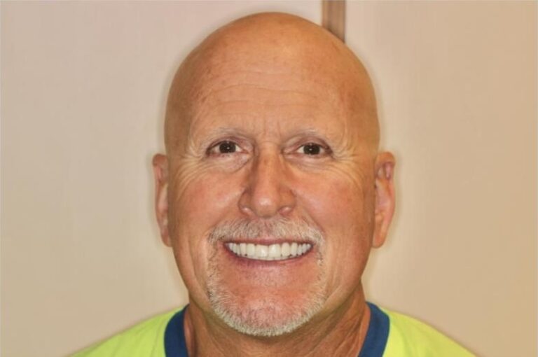 Patient smiling confidently after oral surgery and sedation dentistry at Mona Lisa Smile Dental in Walnut Creek California